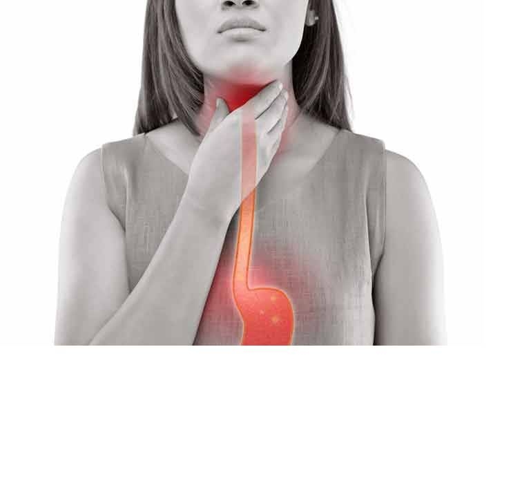 چگونه ریفلاکس اسید باعث تنگی نفس می‌شود