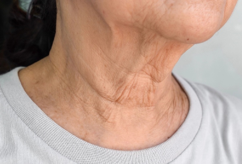 3 راهکار برای مقابله با چروک‌های پوست گردن