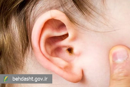 عفونت و آلودگی های صوتی بر کیفیت شنوایی اثر گذار است