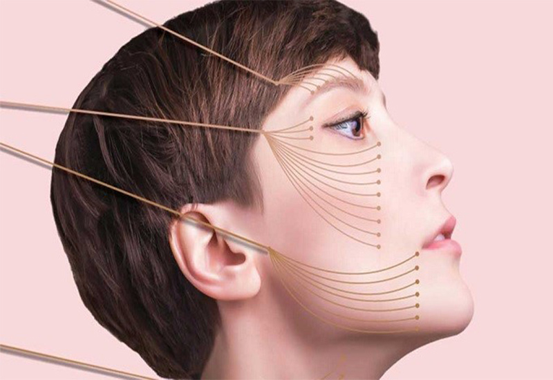 لیفت با نخ؛ پاسخی سریع به علائم پیری