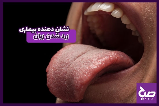 علل زردی زبان