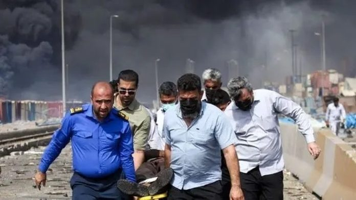 شرحی بر لحظات طاقت‌فرسای تیم درمان مصدومین در ساعات پس از انفجار