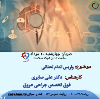 واریس اندام تحتانی 