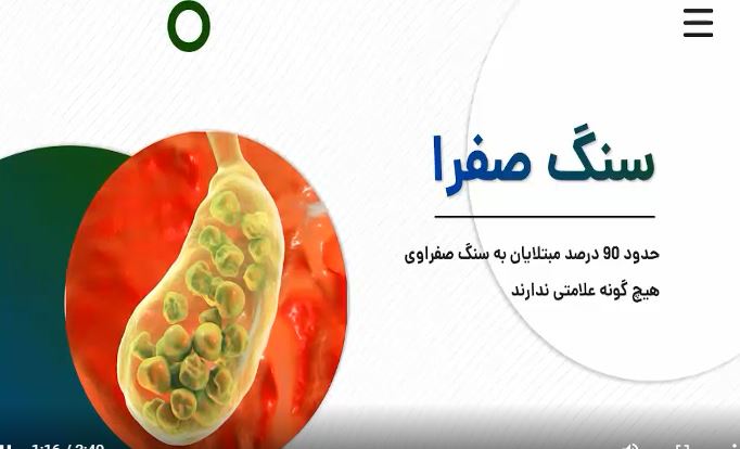 مصرف الکل موجب بیماری سنگ صفرا می شود 