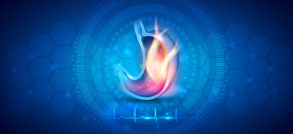 تشخیص و درمان سرطان معده