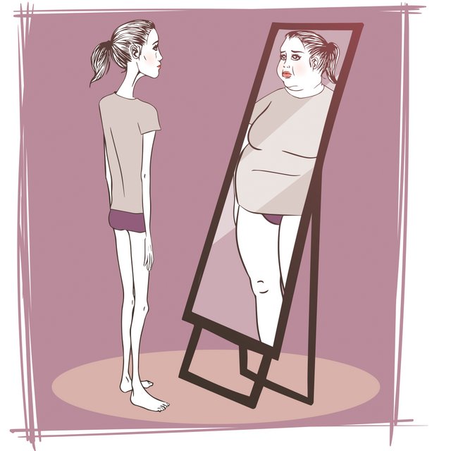اختلالات تغذیه ای (Eating Disorders)