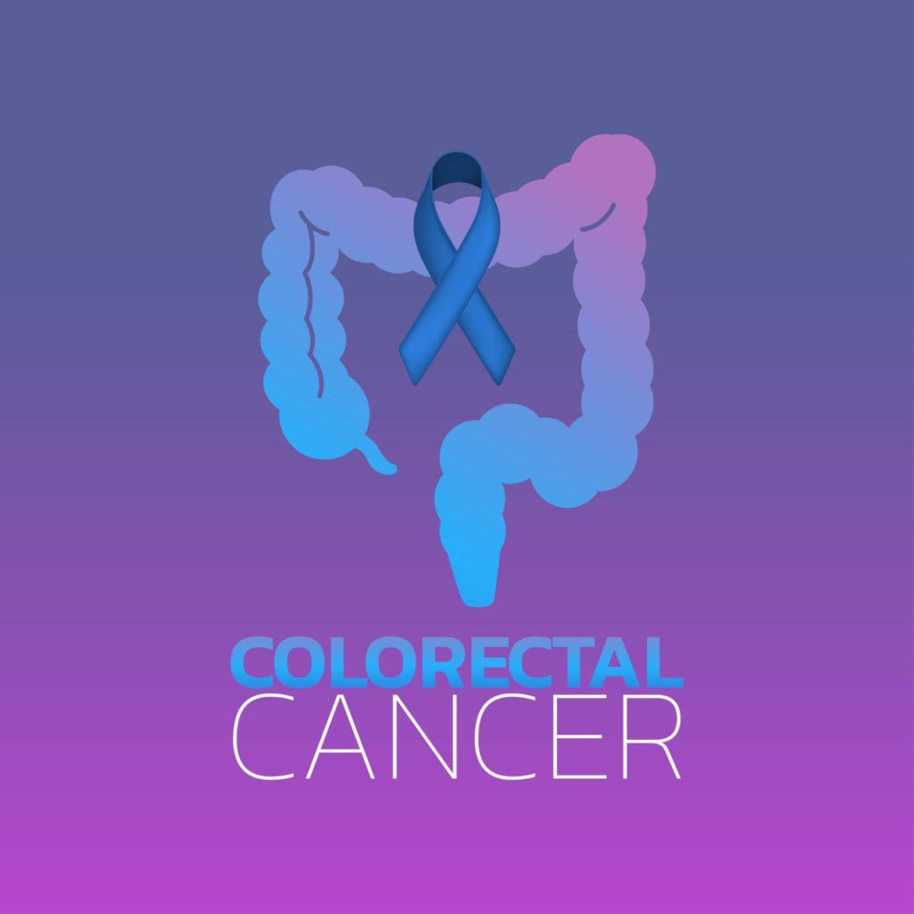 سرطان کولون &#8211; Colorectal Cancer