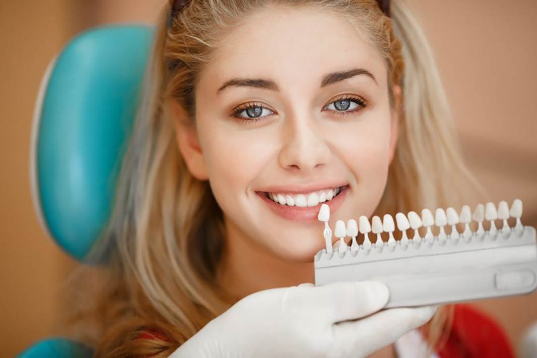 روکش های دندانی و دلایل نیاز به آنها (Dental Crowns) – قسمت دوم