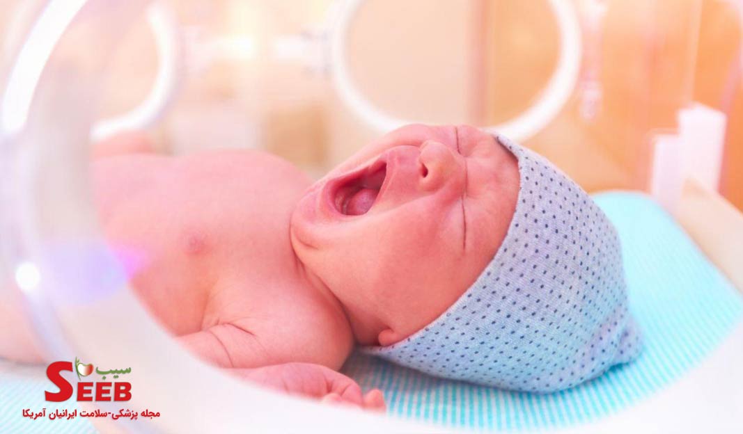 غلبه بر موانع شیردهی در نوزادان نارس و کم وزن