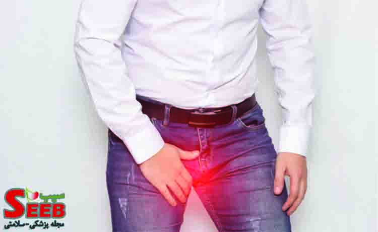 آیا واریکوسل درمان دارد؟