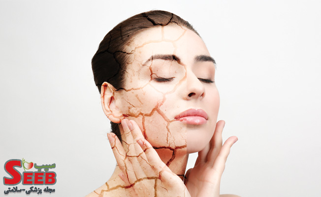 روتین پوست خشک؛ برای مراقبت از پوست خشک چه کنیم؟