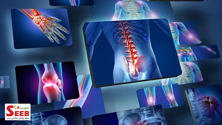 التهاب حاد چیست و علائم آن کدام است؟